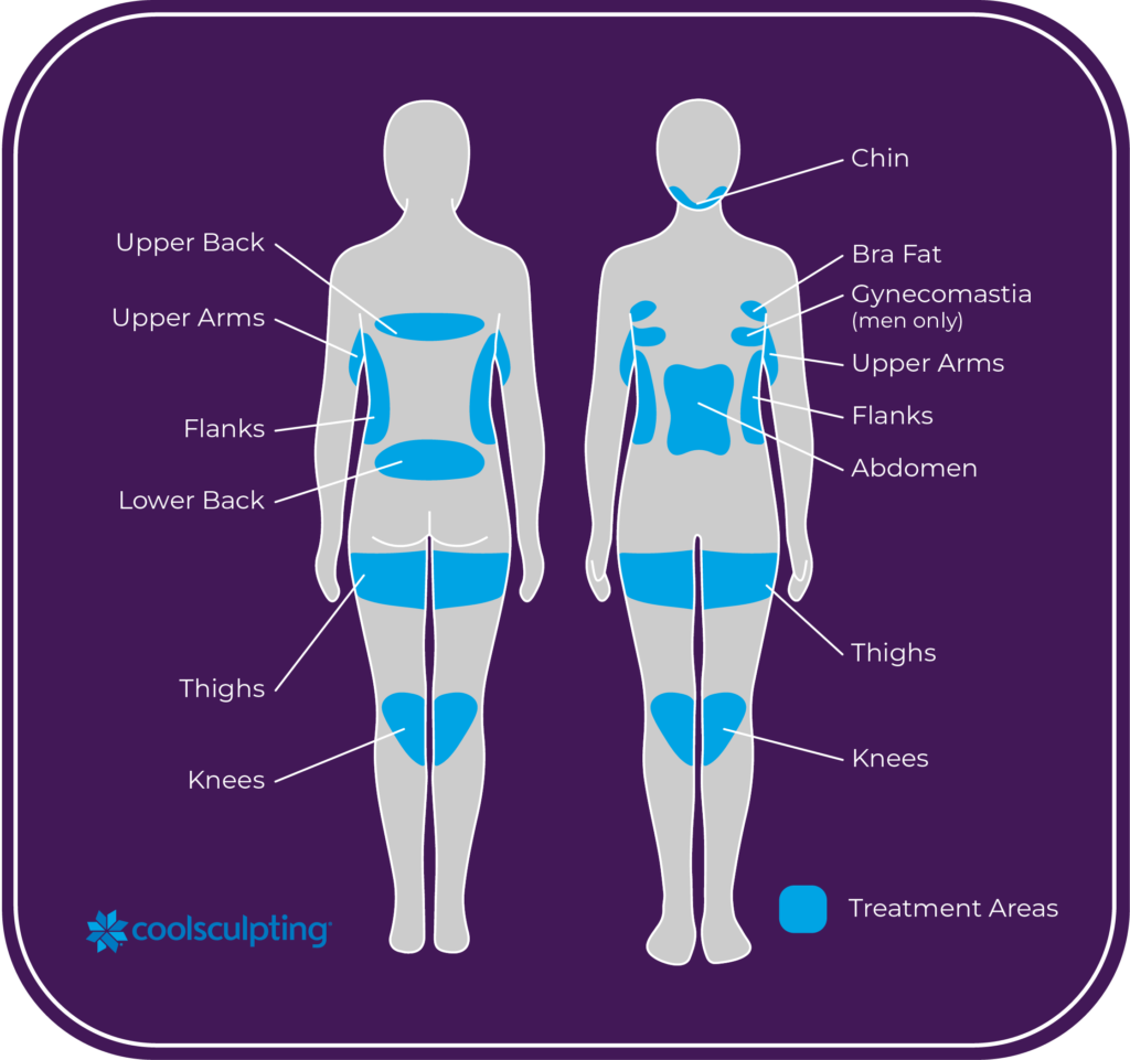 What Areas Can You Have Treated with Coolsculpting®