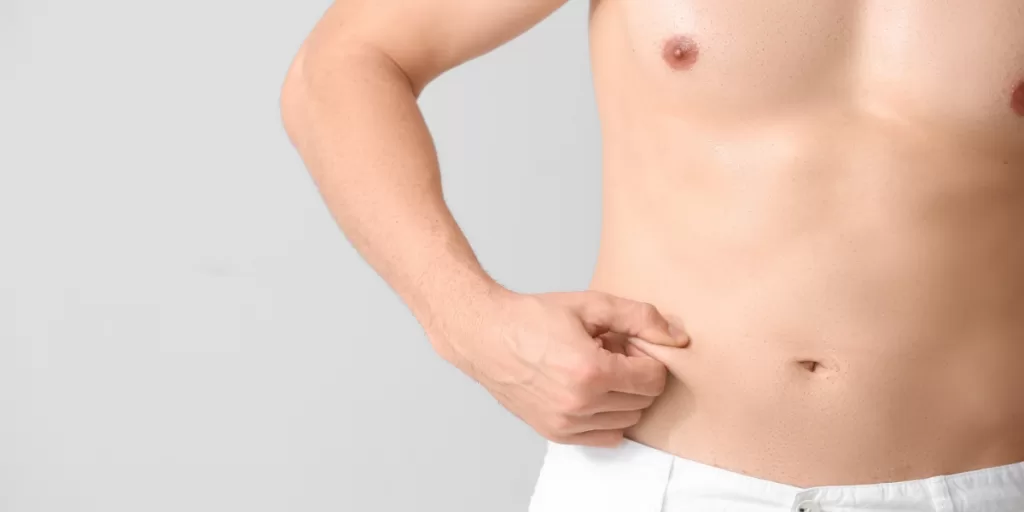Moraitis procedure male tummy tuck image | moraitis plastic surgery Moraitis procedure male tummy tuck image